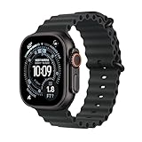 Apple Watch Ultra врятував руку власника від травм після зіткнення з авто 3